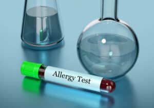 allergie più comuni