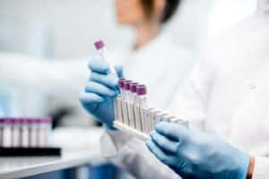analisi del sangue analisi del sangue