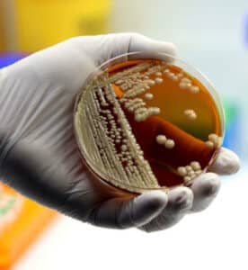 analisi microbiota intestinale 
