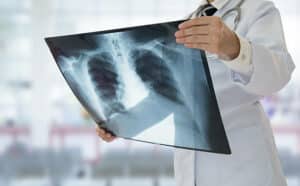 diagnostica di radiologia