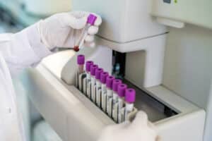 dove effettuare le analisi del sangue