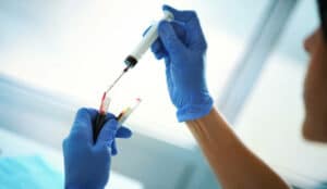dove eseguire il check up per MST