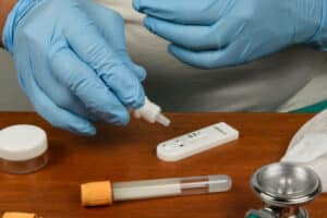 esami per diagnosticare allergie