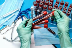 esecuzione test virologico