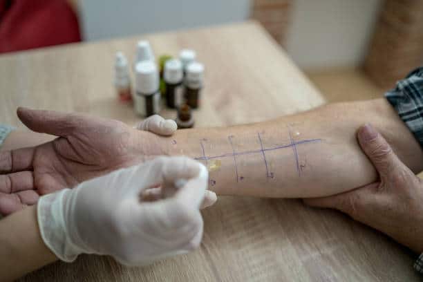 prove allergiche