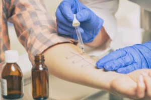 test delle prove allergiche