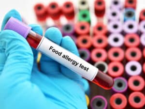 test per le intolleranze alimentari