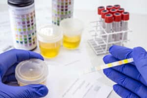 tipologie di test antidroga