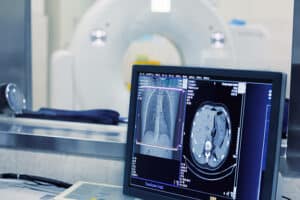 vantaggi diagnostica radiologica