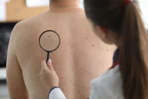 vantaggi esami di dermatologia